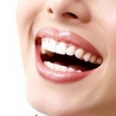 养生警惕 九大坏习惯最伤害牙齿