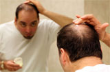 针对三种体质问题 预防男性脱发的食疗方法