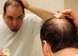 男性脱发怎么办 教你几招轻松预防