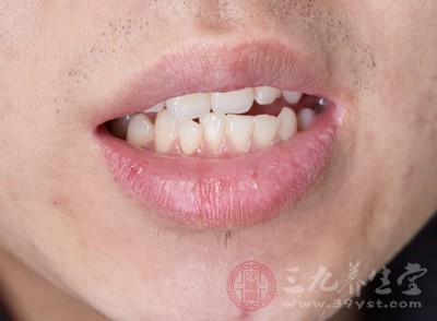 磨牙的原因 长期磨牙竟导致这些严重后果