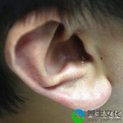 耳朵护理方法