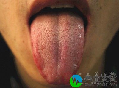 舌头异样背后的疾病