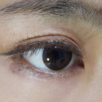 治疗原发性青光眼方剂