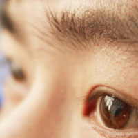 治疗老花眼的偏方 老花眼应该如何预防
