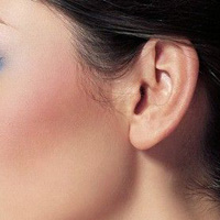 清鼻丸治疗慢性化脓性中耳炎