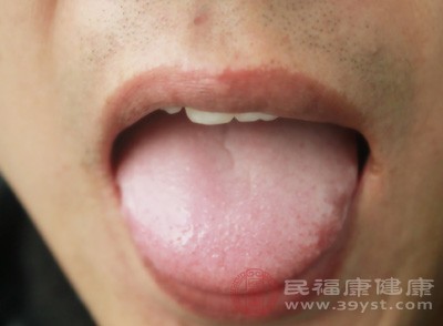 湿气重舌头的表现 舌头这种变化小心是疾病