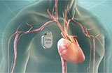 心脏神经官能症的发病原因有哪些 一般该怎么护理