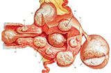 什么是子宫内膜间质肉瘤 一般都有哪些临床表现