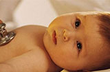 什么是母乳性黄疸？谁说母乳性黄疸就必须断母乳？