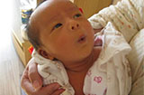 宝宝得了母乳性黄疸怎么办？导致母乳性黄疸的原因
