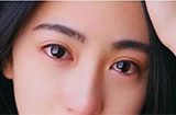 角膜炎有哪些症状？得了角膜炎会影响视力吗？