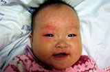 婴儿玫瑰疹应该怎么预防？日常护理宝宝注意这三点
