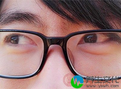 戴眼镜可以减少你的眼睛受到影响的机会
