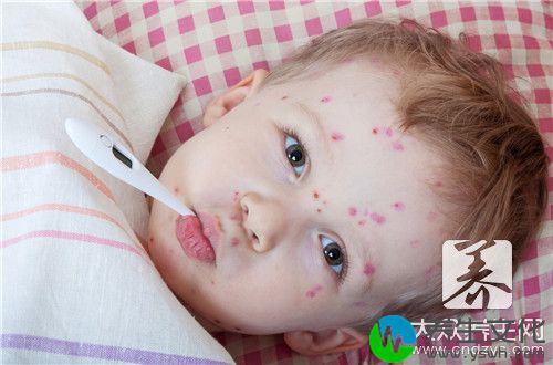 孩子咳嗽能打疫苗吗