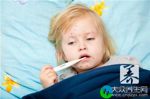  小孩出麻疹是什么症状