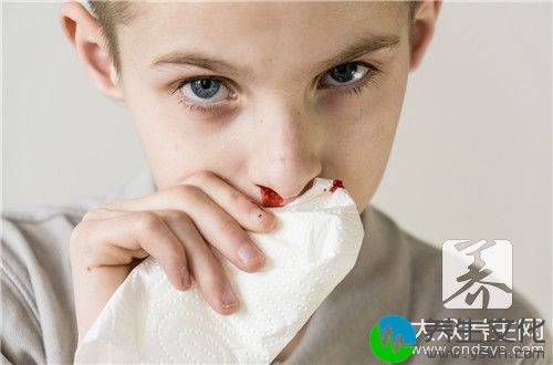  儿童过敏性鼻炎的妙招