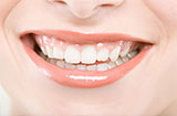 牙齿黄怎么办 七个小偏方恢复亮白牙齿