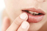 口炎症疼痛难忍 6种口角炎的治疗方法