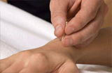 贴针灸对手腕痛的如何治疗 治疗原理有哪些
