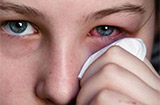 红眼病的症状有哪些常见表现