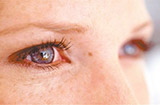 红眼病的晚期有哪些常见症状