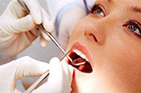 牙周炎的五大护理方法 牙周炎的护理原则