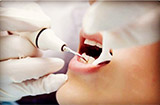 预防牙周炎应该怎么做