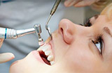 牙周炎有什么特点 牙周炎有哪些特别的表现