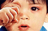 儿童沙眼有哪些症状 预防儿童沙眼应该怎么做