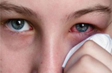 沙眼早期有哪些常见症状 沙眼初期症状介绍