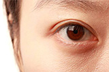 沙眼的症状有哪些常见表现 得了沙眼该怎么办