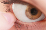 沙眼症状有哪些 不同时期有不同症状