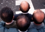 秃顶男人有哪些优势 如何预防男人过早秃顶？